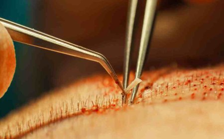 What Are The Causes Of Hair Loss?