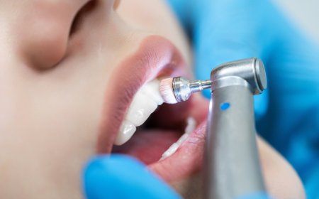 How Regular Cleanings Prevent Costly Dental Treatments in Bloomfield