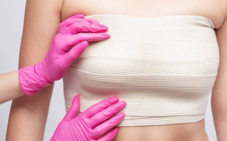 Breast Reconstruction Market Trends and Growth Analysis
