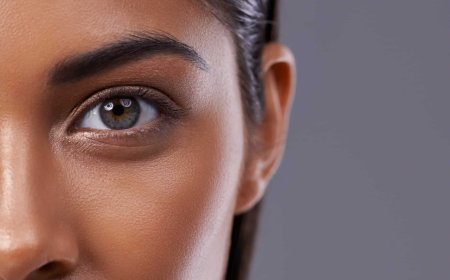Lower Blepharoplasty Dubai: Achieve a Refreshed Look with Expert Eye Bag Removal