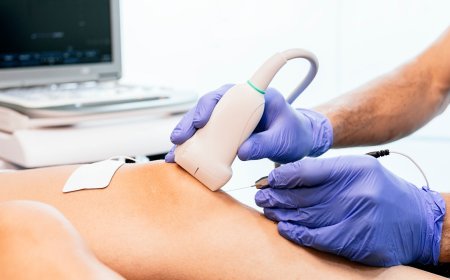 Vascular Closure Device Market Growth and Innovations