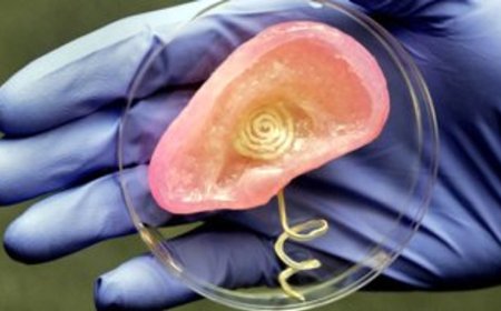 Artificial Vital Organs And Medical Bionics Market Set to Soar with 3D