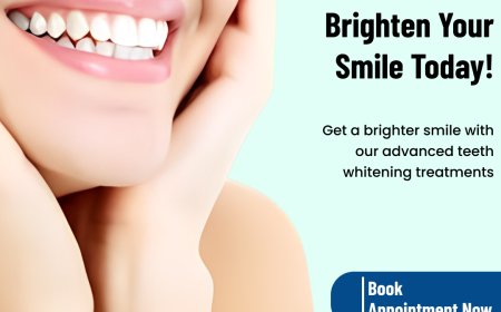 Teeth Whitening Hoodi Bangalore: Your Guide to a Brighter Smile