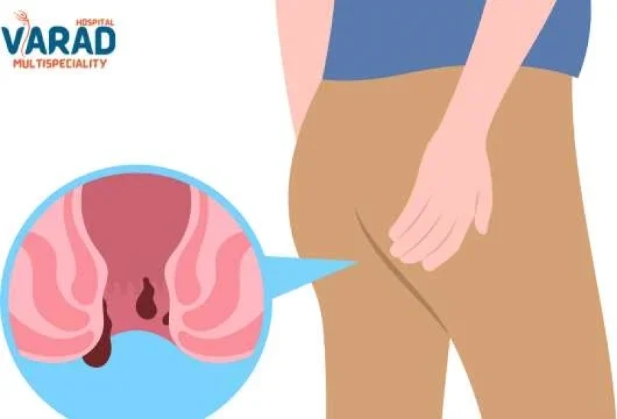 Piles Doctor in Pune – Your Path to Comfortable, Confidential, and Complete Relief