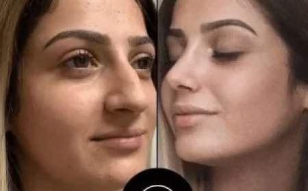 Trust, Talent, and Transformation: The Best Plastic Surgeon in Dubai