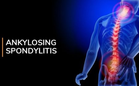 Ankylosing Spondylitis Market Size, Trends, and Strategic Outlook 2025-2032