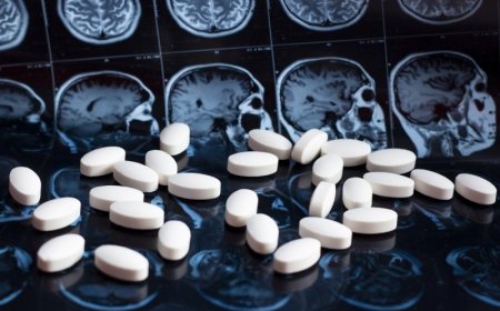 Alzheimer’s Drugs Market Size, Trends, and Strategic Outlook 2025-2032