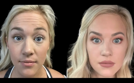 Natural-Looking Botox: Secrets from the Best Aesthetic Clinics in dubai