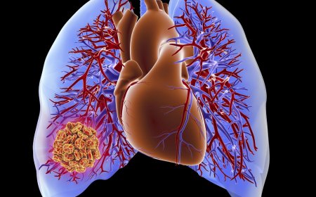 Chronic Thromboembolic Pulmonary Hypertension Market Growth and Segment Analysis 2025-2032